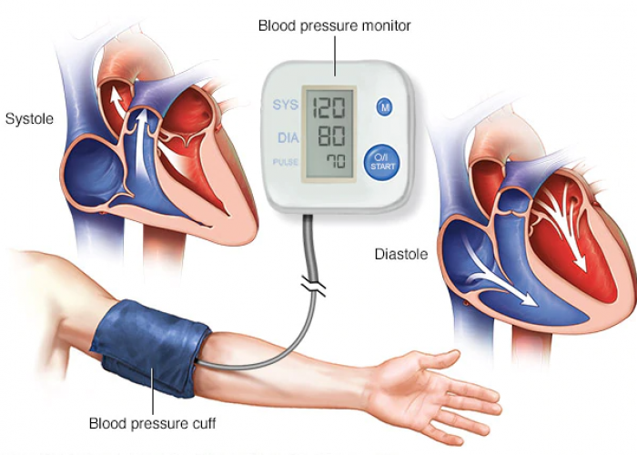 میزان نهایی فشار خون افراد مختلف
